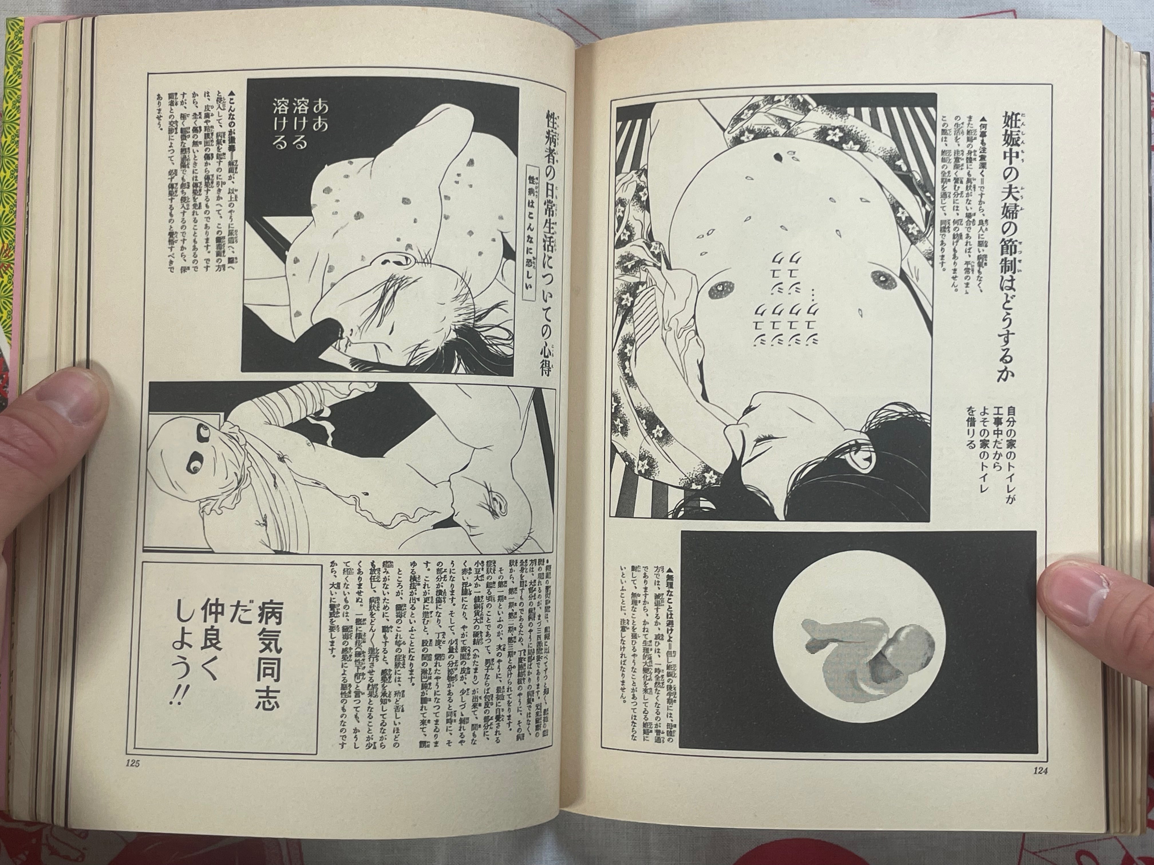 Q-Saku Dream by Suehiro Maruo (1993)